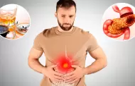 Sufres de pancreatitis? Estos ALIMENTOS comunes podran estar daando tu SALUD sin que lo notes