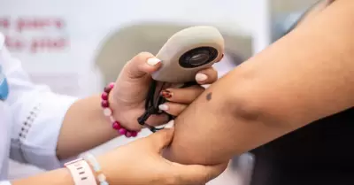 EsSalud despeja duda sobre afectación de la piel en invierno.