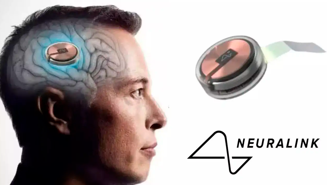 Elon Musk propone chips cerebrales para ayudar a los ciegos.