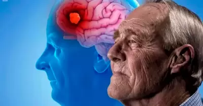 Hábito que podría ayudar a prevenir el Alzheimer.
