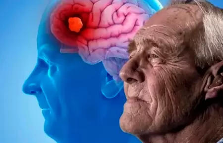 Hábito que podría ayudar a prevenir el Alzheimer.