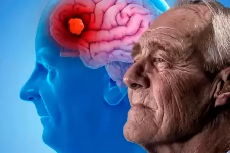 Hbito que podra ayudar a prevenir el Alzheimer.