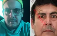 Furrey: Poder Judicial dicta 6 meses de prisin preventiva a chofer acusado de tentativa de homicidio