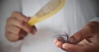 Caída de cabello