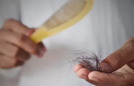 Cada de cabello