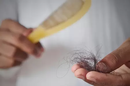 Cada de cabello