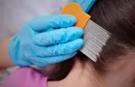 Piojos en temporada escolar: Cmo detectarlos y qu tratamientos s funcionan?