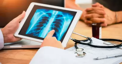 Alimento que ayuda a cuidar tus pulmones.