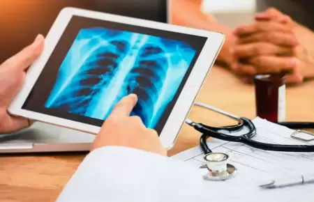 Alimento que ayuda a cuidar tus pulmones.