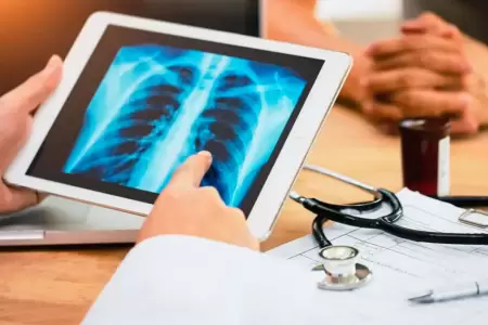 Alimento que ayuda a cuidar tus pulmones.