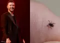 El cantante Justin Timberlake revela que fue diagnosticado con una extraa enfermedad