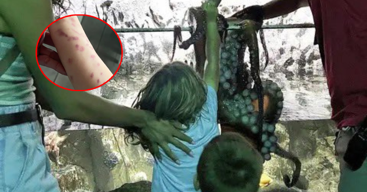 Niño de seis años sufrió ataque de pulpo en acuario de Texas, EE.UU: Animal lo dejó con lesiones en un brazo
