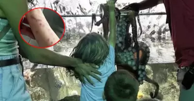 Niño acabó con lesiones por ataque de pulpo.