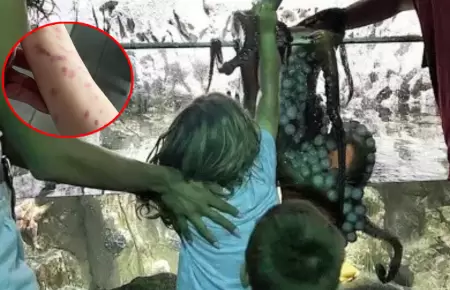 Nio acab con lesiones por ataque de pulpo.