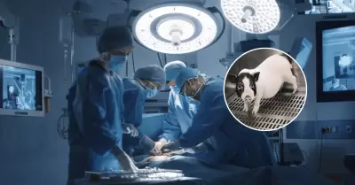 Un hito en la medicina: Trasplantan por primera vez pulmón de cerdo a un humano