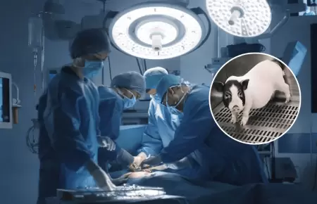 Un hito en la medicina: Trasplantan por primera vez pulmn de cerdo a un humano