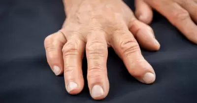 Artritis reumatoide sería agravada por el envejecimiento inmunológico.