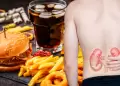 Problemas renales? Aqu estn los alimentos que podran estar afectando tus riones, segn expertos