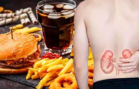 Alimentos que debes limitar para cuidar la salud de tus riones.