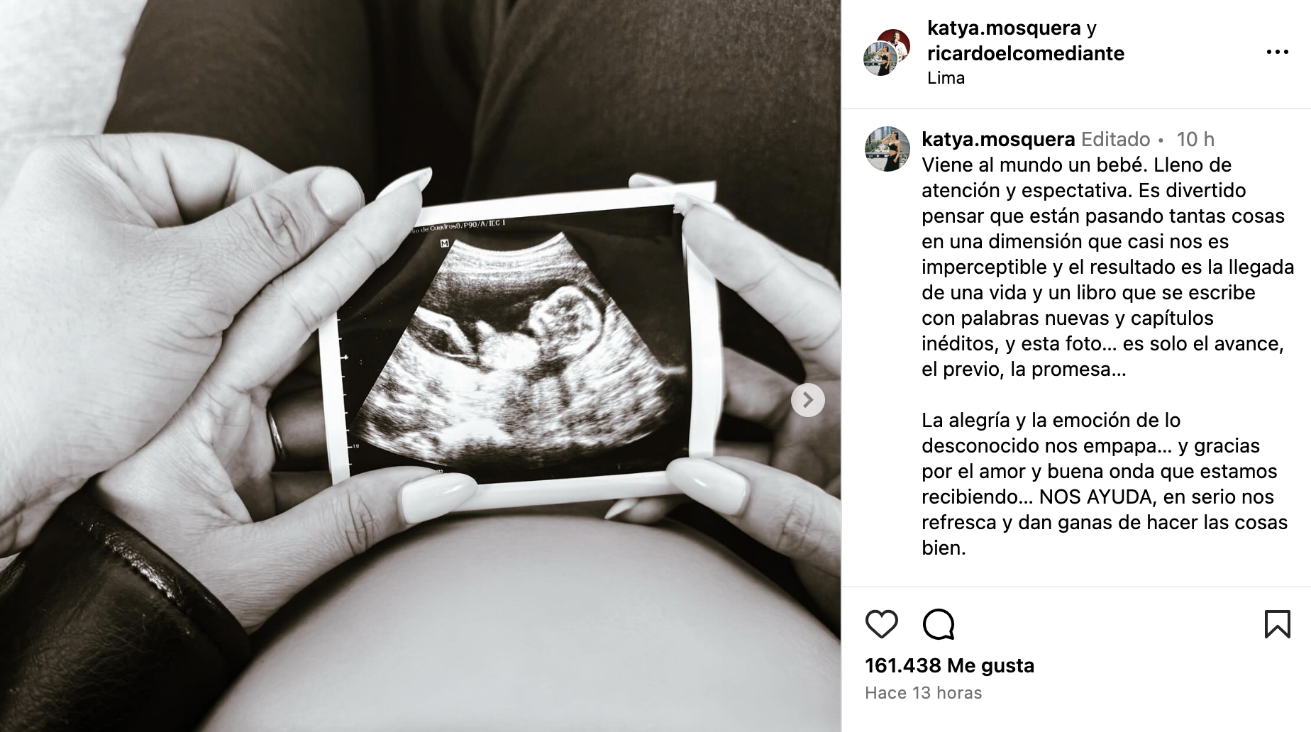 Ricardo Mendoza muestra ecografa de su primer beb con Katya Mosquera