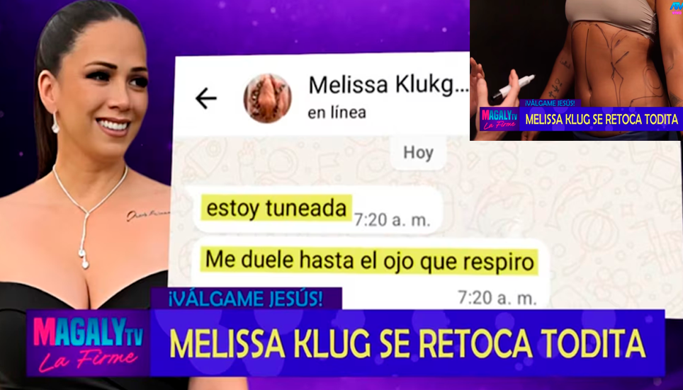 Melissa Klug se realiza retoques estticos tras separacin de Jess Barco.