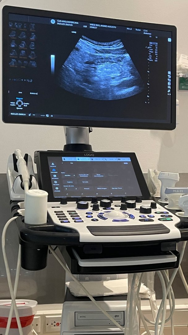 Ecografía publicada por Andrés Wiese