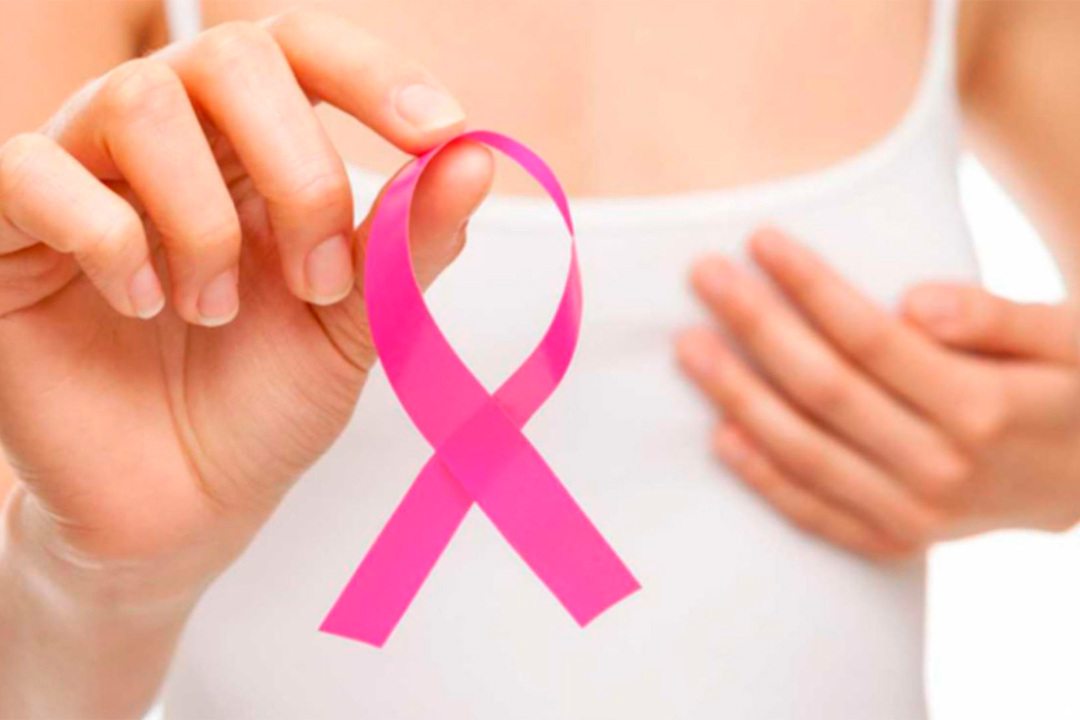 El cncer de mama es una de las principales causas de muerte en mujeres en el Per.