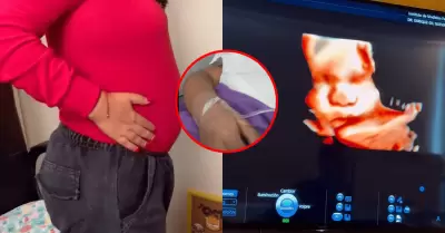 Periodista peruana es hospitalizada tras romperse fuente de su embarazo