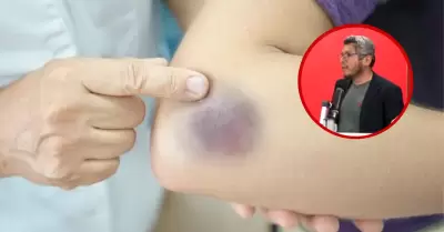 Desabastecimiento para tratamiento de hemofilia por meses