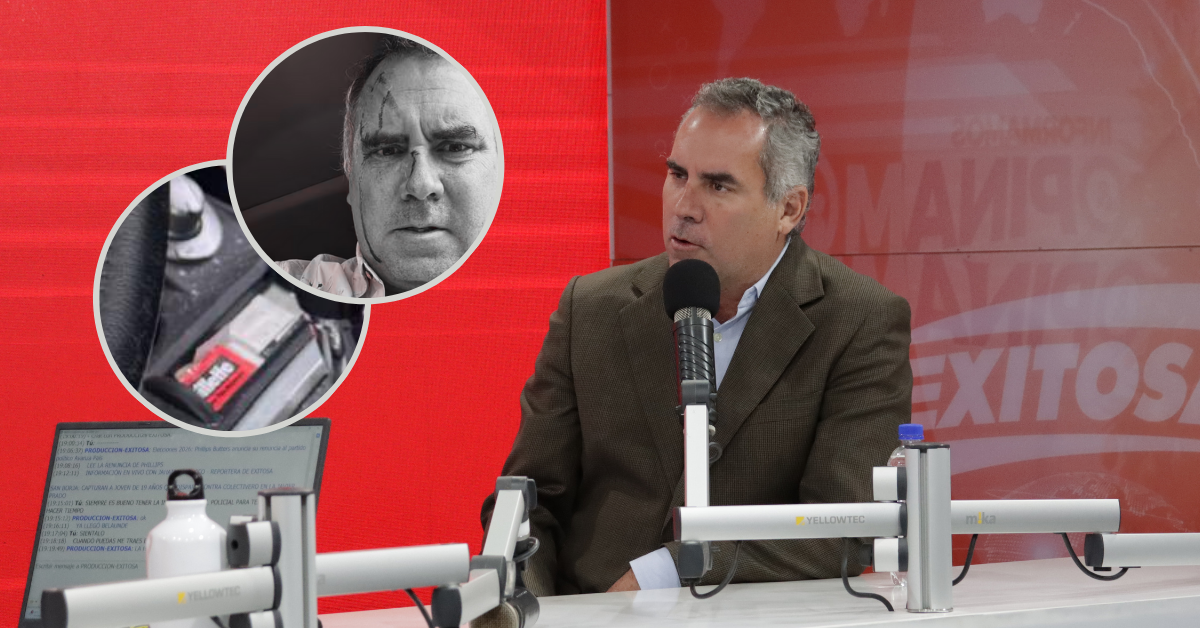 Belaunde Llosa asegura no haberse causado las lesiones