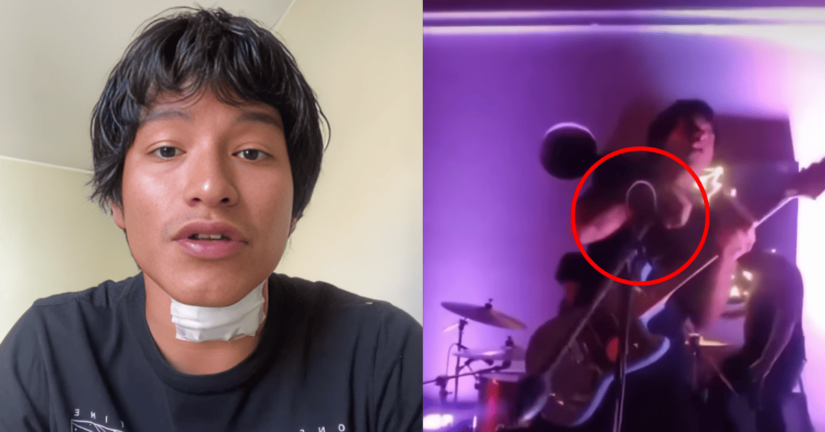 Cantante que sufrió descarga eléctrica en concierto ROMPE SU SILENCIO: "Paralizado unos 7 segundos"