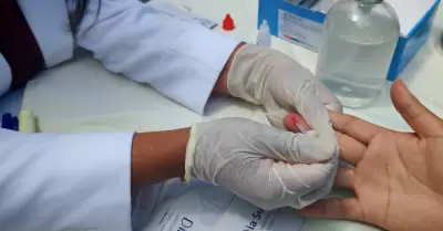 Lucha contra el VIH se conmemora este 1 de diciembre