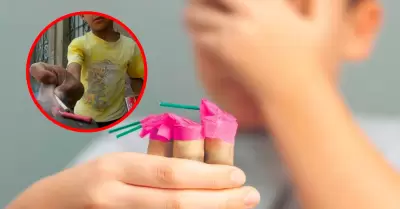 Autoridades advierten que riesgo de quemaduras y lesiones aumentan en un 30% dur