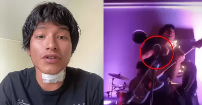 Cantante rompe su silencio tras electrocutarse en concierto