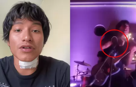 Cantante rompe su silencio tras electrocutarse en concierto