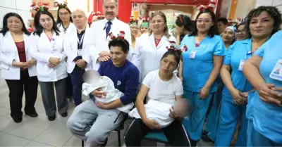 Siamesas separadas en v�speras de la Navidad.