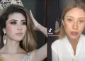 Miss Arequipa 2025 denuncia agresi�n f�sica por parte de su expareja: "No me voy a callar m�s"