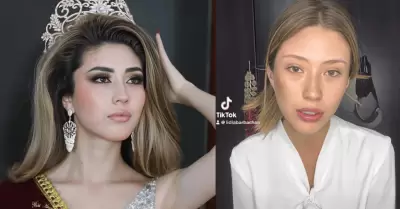 Miss Arequipa 2025 denuncia agresi�n f�sica por parte de su expareja
