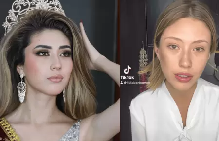 Miss Arequipa 2025 denuncia agresi�n f�sica por parte de su expareja