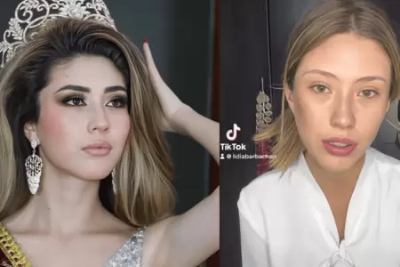 Miss Arequipa 2025 denuncia agresi�n f�sica por parte de su expareja