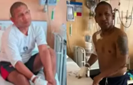 Sujeto que quem� a su pareja en Barrios Altos minimiz� su agresi�n.