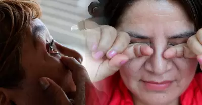 Alertan aumento de infecci�n por conjuntivitis en verano