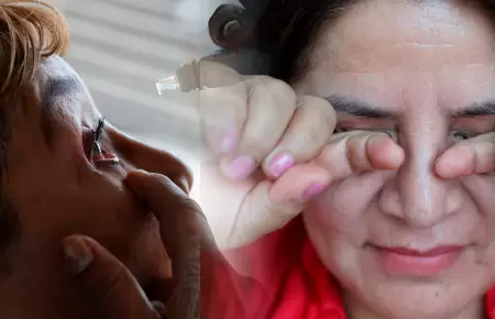 Alertan aumento de infecci�n por conjuntivitis en verano