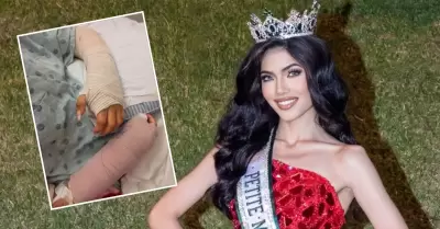 Modelo peruana sufre accidente con pirotecnia