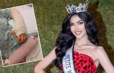 Modelo peruana sufre accidente con pirotecnia