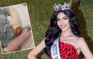 Modelo peruana, que participaba en el Mesoam�rica International 2026, abandona concurso tras accidente con pirotecnia
