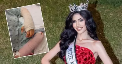 Modelo peruana sufre accidente con pirotecnia