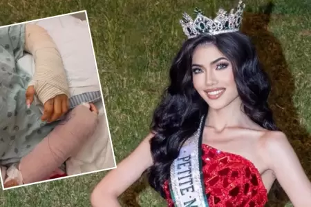 Modelo peruana sufre accidente con pirotecnia