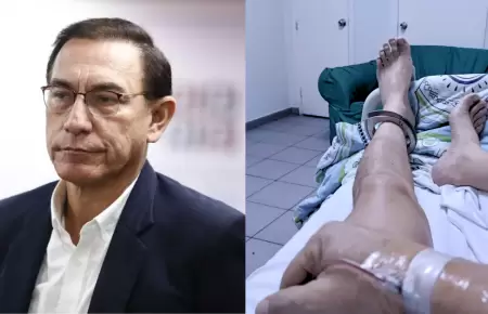 Mart�n Vizcarra anuncia que perdi� un ri��n tras intervenci�n quir�rgica.