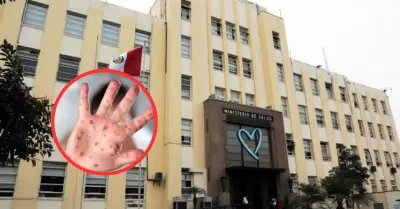 Minsa emite alerta epidemiol�gica ante posible importaci�n y contagio de sarampi